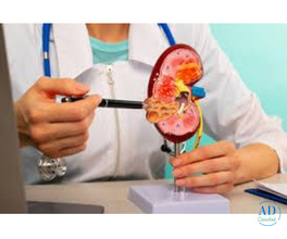 Best Kidney Transplant in Mumbai for Long-Term Kidney Health | Dr. Chandan Chaudhari