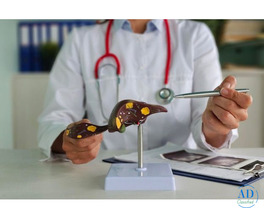 Why Choose a Homeopathy Doctor for Liver Disease Treatment?