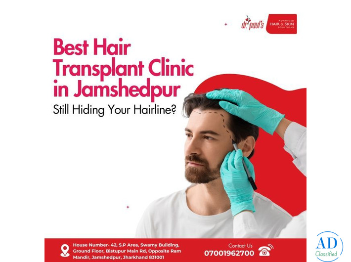 Best Hair Transplant Clinic in Jamshedpur – Still Hiding Your Hairline?