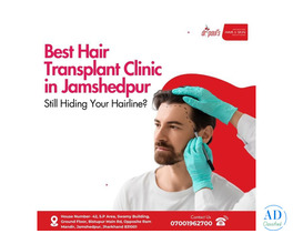 Best Hair Transplant Clinic in Jamshedpur – Still Hiding Your Hairline?