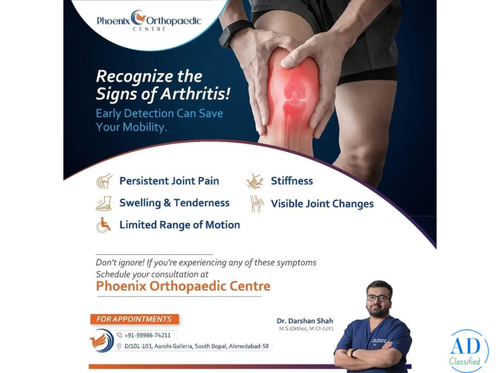 3D Robotic Total Knee Replacement in Ahmedabad – Consult Now