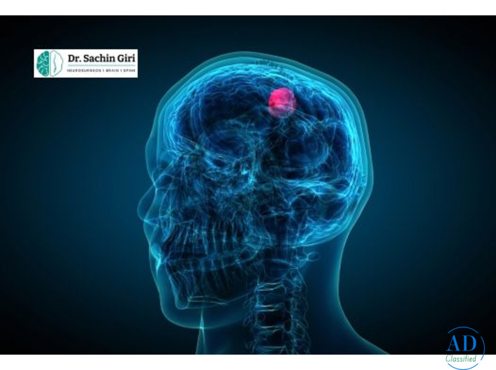 Advanced Pediatric Brain Tumor Surgery in Mumbai by Dr. Sachin Giri