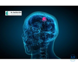 Advanced Pediatric Brain Tumor Surgery in Mumbai by Dr. Sachin Giri