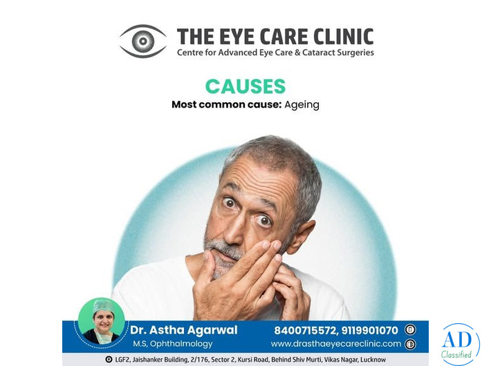 Motiyabind Operation in Lucknow | Dr. Astha Agarwal – The Eye Care Clinic