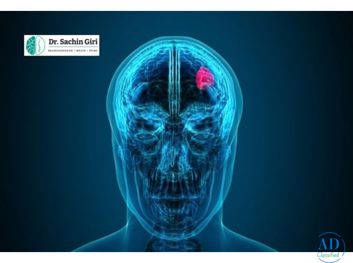 Brain Tumor Removal Surgery in Mumbai by Dr. Sachin Giri