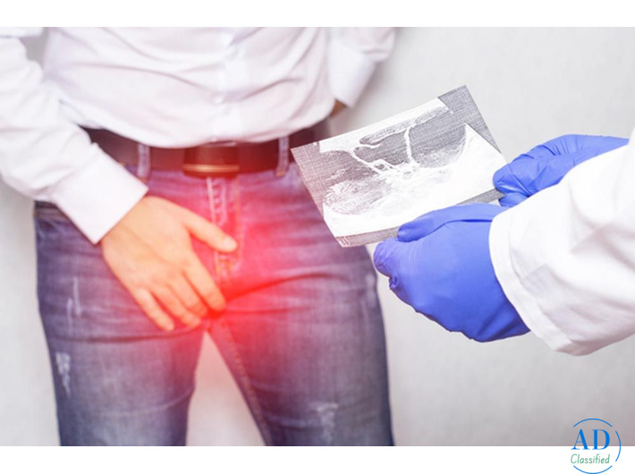 Consult an Experienced Varicocele Specialist for Advanced, Personalized Care