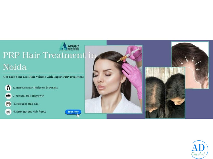 PRP Hair Treatment in Noida | Best Hair Loss Treatment - Apolo Hair Studio