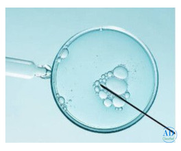 IVF Treatment in Kolkata at Uma Medical | Trusted Fertility Care