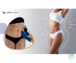 Trusted Liposuction Experts in Surat – Callisto Clinic