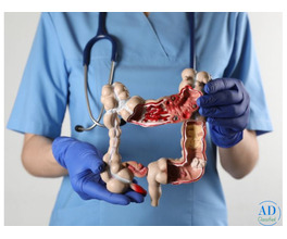 Best Colon Cancer Surgeon in Ahmedabad – Advanced Cancer Care