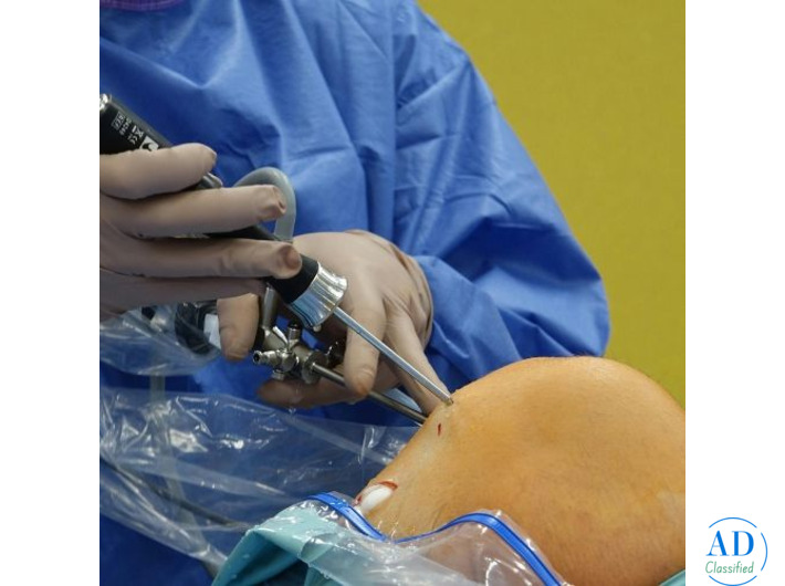 Top Knee Replacement Surgeon in Ahmedabad – Elite Hospital