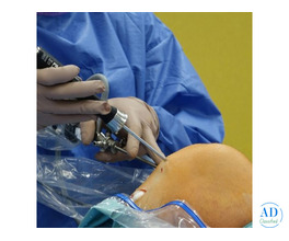 Top Knee Replacement Surgeon in Ahmedabad – Elite Hospital