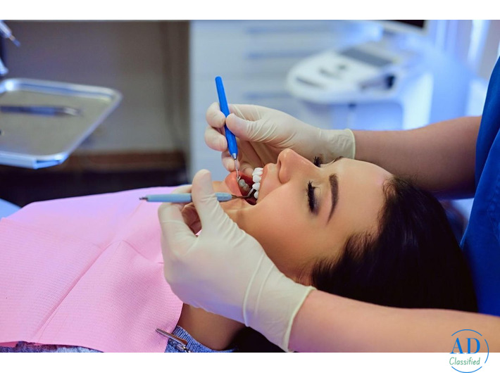 Tooth Colored Fillings Treatment in Gujarat - DR. Manish Shah