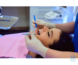 Tooth Colored Fillings Treatment in Gujarat - DR. Manish Shah