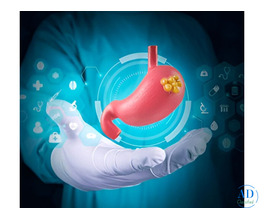 Best Stomach Cancer Surgeon in Ahmedabad – Dr. Nitin Singhal