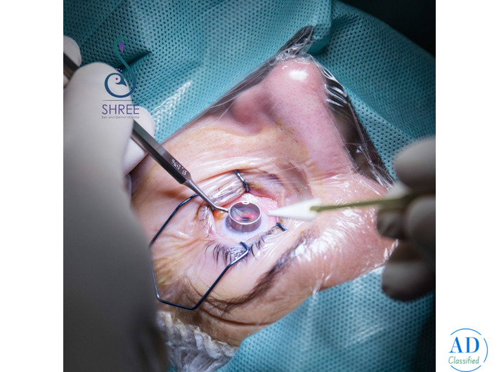 Cataract Surgery in Ahmedabad at Shree Eye and Dental Hospital