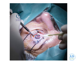 Cataract Surgery in Ahmedabad at Shree Eye and Dental Hospital