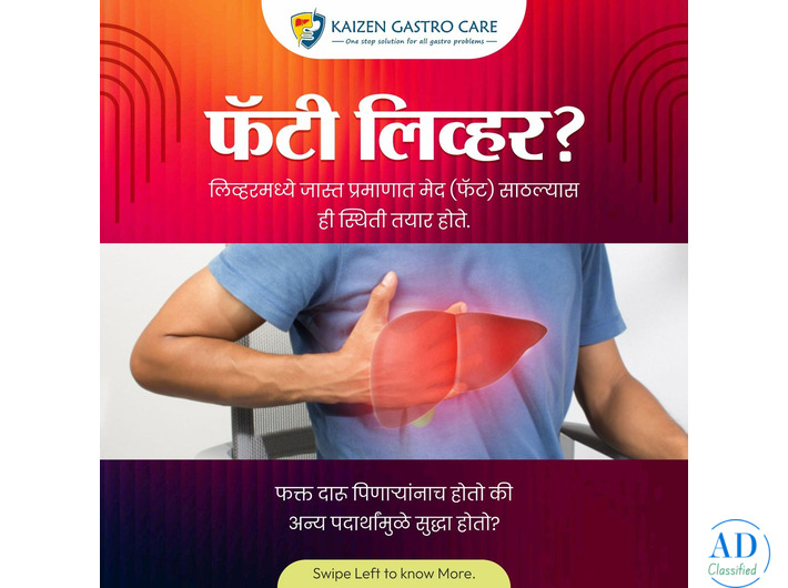 Fatty Liver Disease Treatment in Pune – Kaizen Gastro Care
