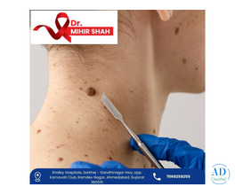 Highly Experienced Head and Neck Cancer Surgeon in Ahmedabad Dr Mihir Shah