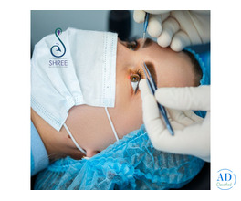 Refractive Surgery in Ahmedabad at Shree Eye and Dental Hospital
