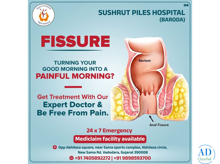 Advanced Anal Fissure Treatment at Sushrut Piles Hospital