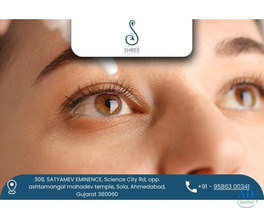 Best Dry Eyes Treatment in Ahmedabad at Shree Eye and Dental Hospital