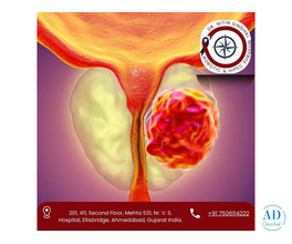 Best Prostate Cancer Surgeon in Ahmedabad – Dr. Nitin Singhal