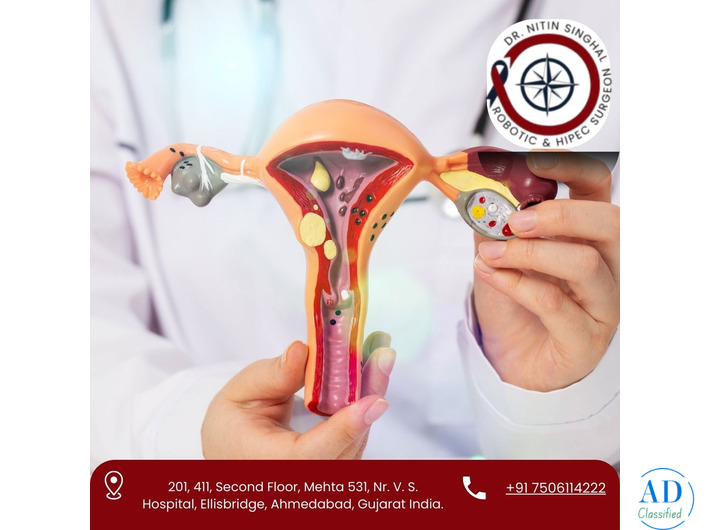 Best Urinary Bladder Cancer Treatment in Ahmedabad – Dr. Nitin Singhal