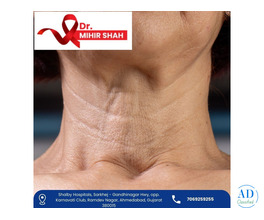 Senior Specialist Head and Neck Cancer Surgeon in Ahmedabad Dr Mihir Shah
