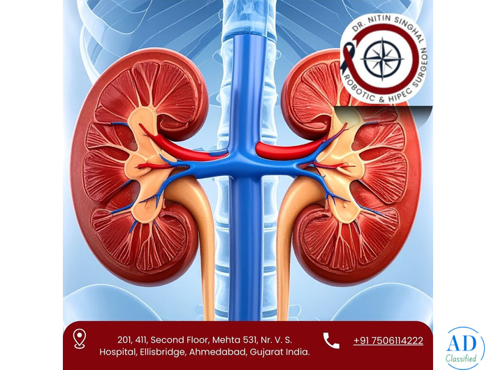 Expert Kidney Cancer Surgeon in Ahmedabad – Dr. Nitin Singhal
