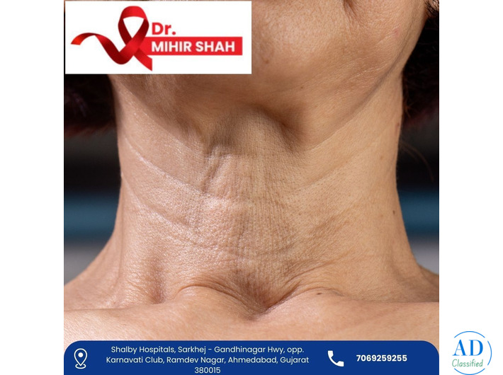 Specialist Head and Neck Cancer Surgeon in Ahmedabad Dr Mihir Shah