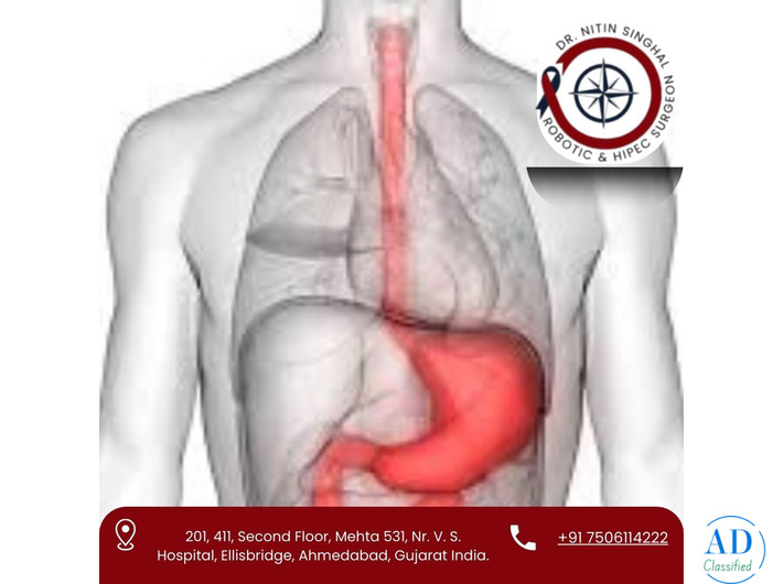 Specialist Stomach Cancer Surgeon in Ahmedabad – Dr. Nitin Singhal