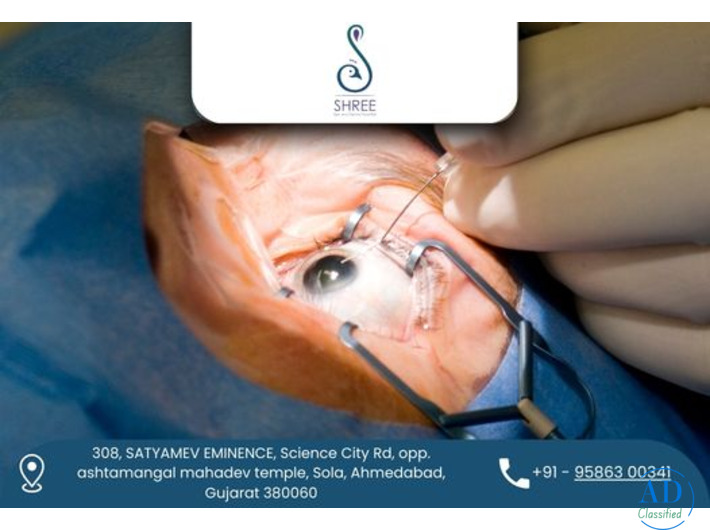 PHACO Surgery in Ahmedabad at Shree Eye and Dental Hospital