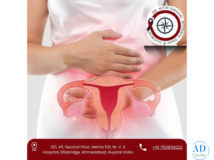 Ovarian Cancer Treatment in Ahmedabad by Dr. Nitin Singhal