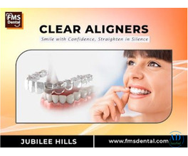 CLEAR ALIGNERS – The Modern Way to Straighten Teeth