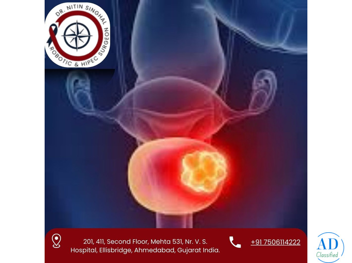 Advanced Bladder Cancer Treatment in Ahmedabad – Dr. Nitin Singhal