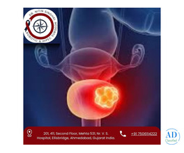 Advanced Bladder Cancer Treatment in Ahmedabad – Dr. Nitin Singhal