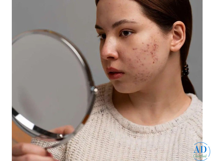 Expert Pigmentation Care in Dubai – Find Your Best Solution