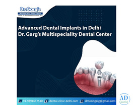 Advanced Dental Implants in Delhi | Dr. Garg’s Multispeciality Dental Center