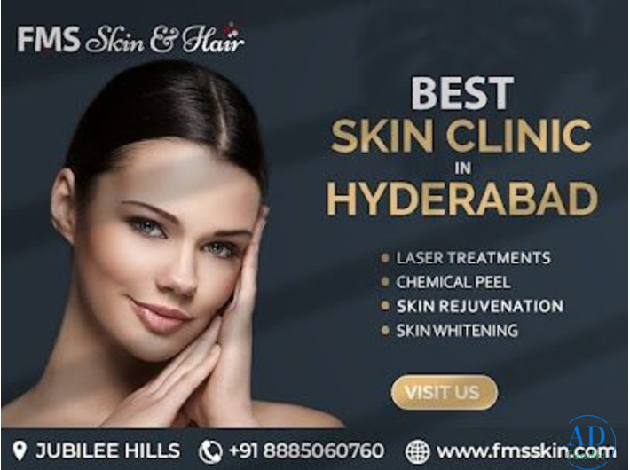 best skin clinic in Hyderabad