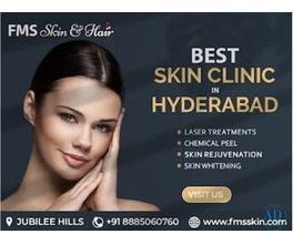best skin clinic in Hyderabad