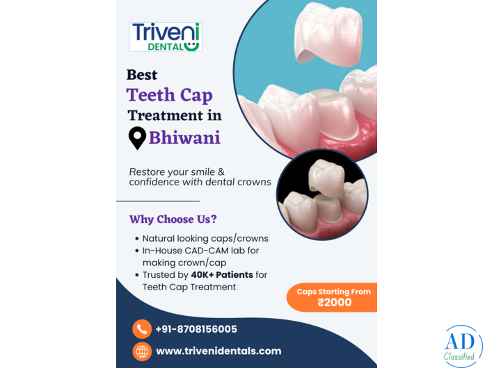 Best Teeth Cap (Crown) Treatment in Bhiwani | Triveni Dental