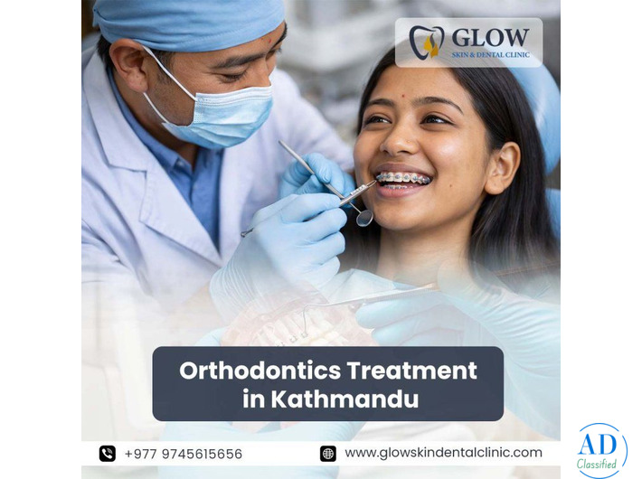 Best Orthodontics Treatment in Kathmandu
