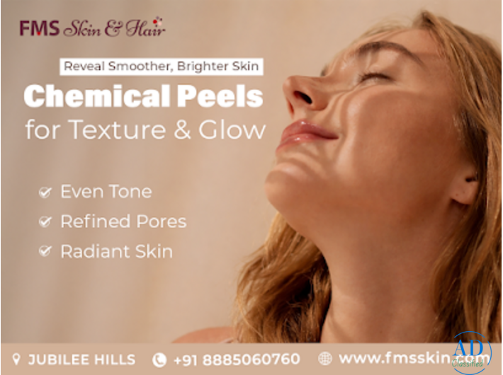 chemical peel treatment in Hyderabad - FMS Skin & Hair