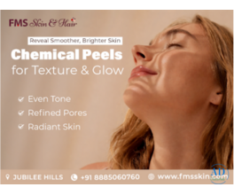 chemical peel treatment in Hyderabad - FMS Skin &amp; Hair