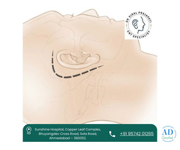 Best ENT Doctor for Facial Nerve Decompression in Ahmedabad – Dr. Viral Prajapati