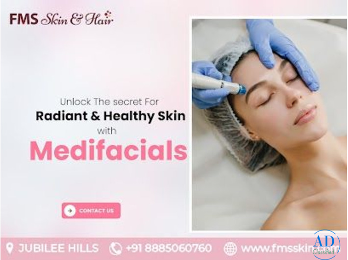 Medifacial Treatment in Hyderabad - FMS Skin & Hair