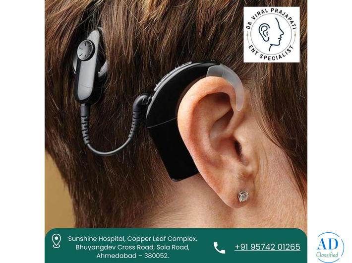 Advanced Cochlear Implant Surgeon in Ahmedabad – Dr. Viral Prajapati