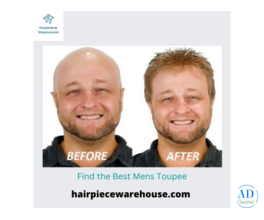 Best Hair Systems for Men for Natural Style and Confidence