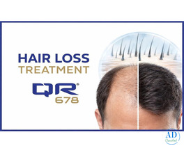 Effective Hair Loss Treatment with Advanced QR678 Formula